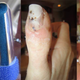 Illustration for article titled Owner Claims $225K Bentley Did This To His Wife's Thumb